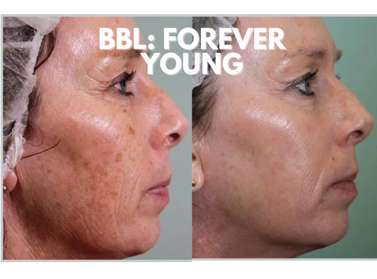 BBL: Forever Young (3-Treatment Package)